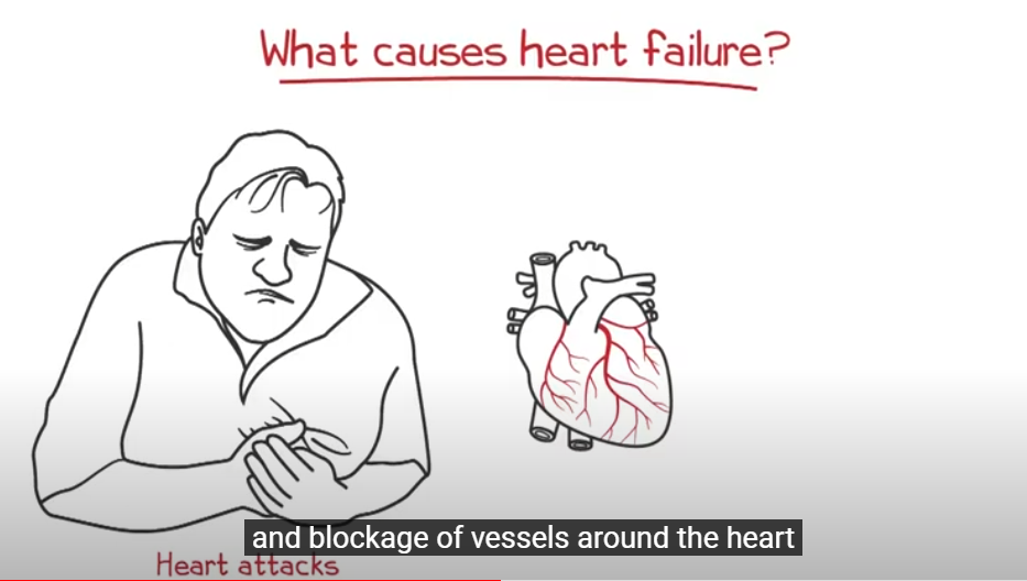 Heart Failure Animation